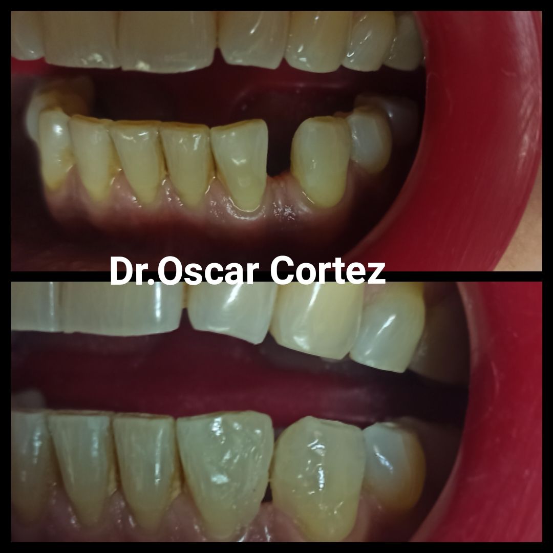 Oscar Cortez Perez-7