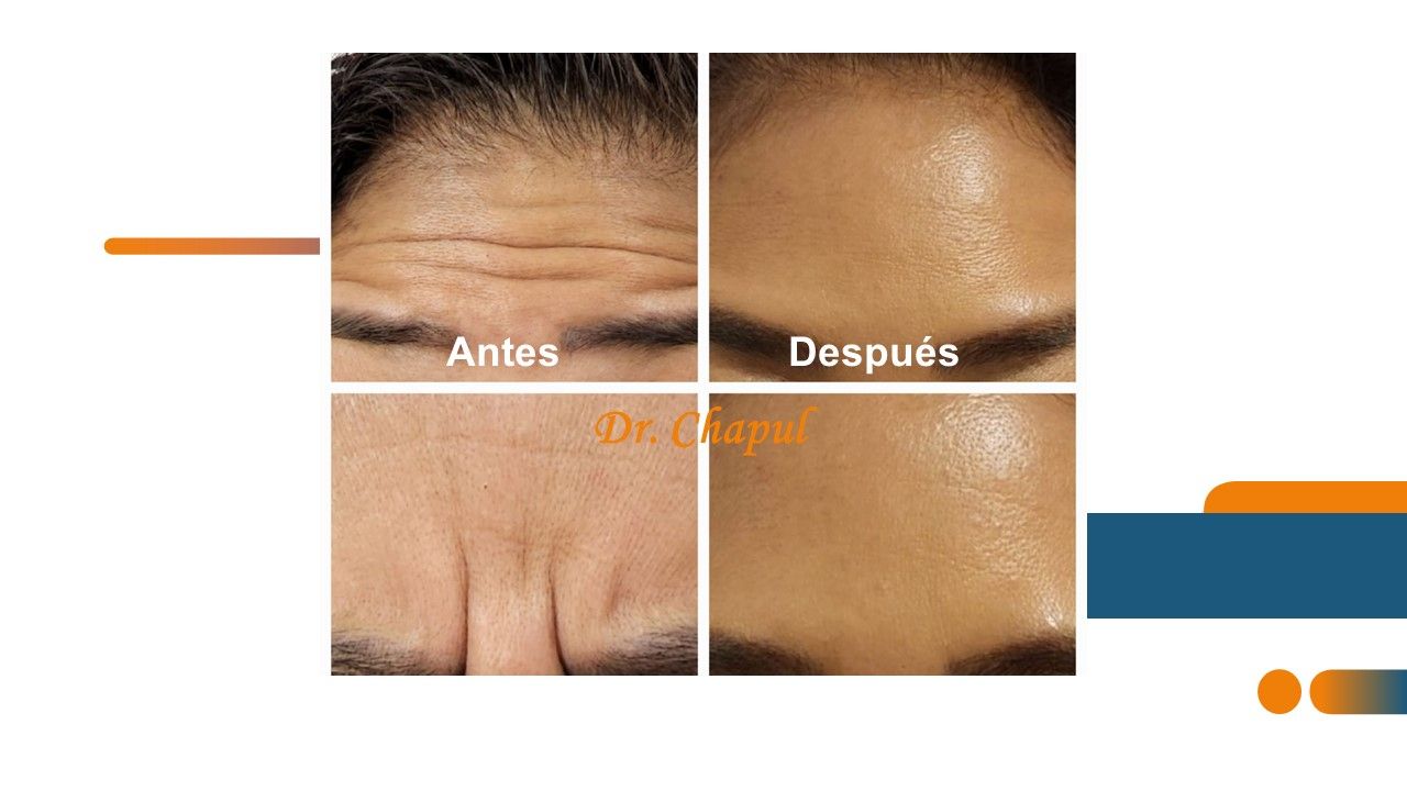 José Luis Muñoz Chapul-24