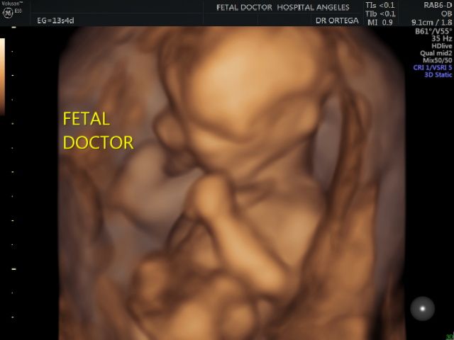 Jesús Manuel Ortega Flores-1