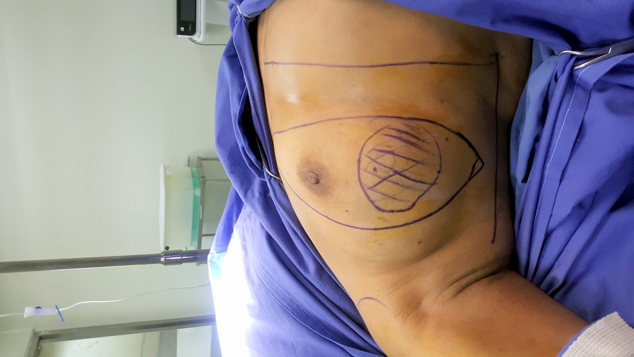 Ángel Millán Juárez-41