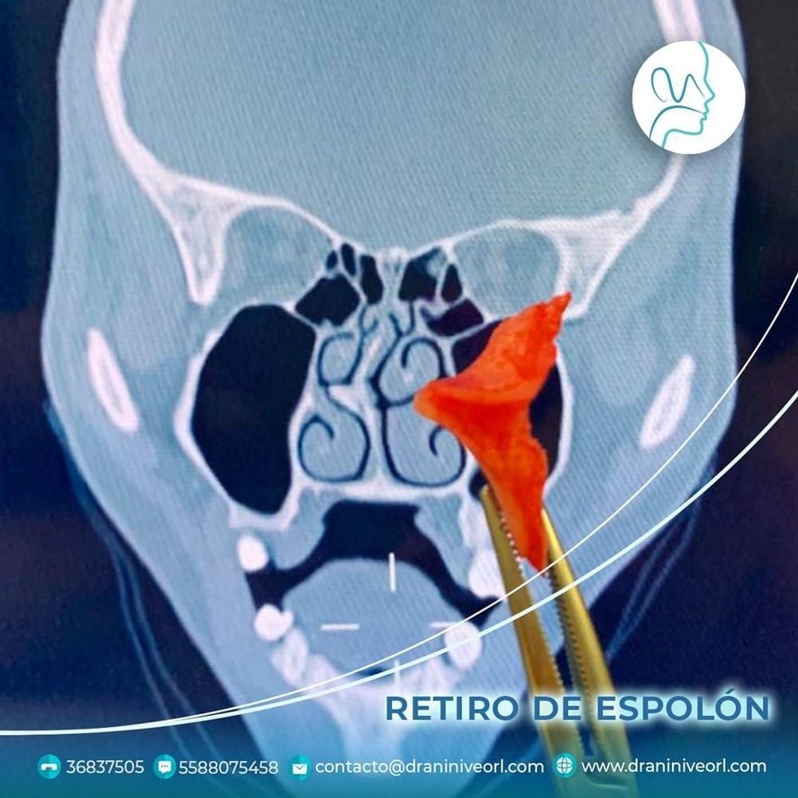 Nínive Jiménez Carreón-10