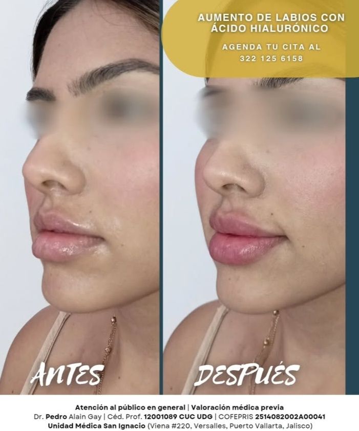 Pedro Alain  Gay Hernández -11