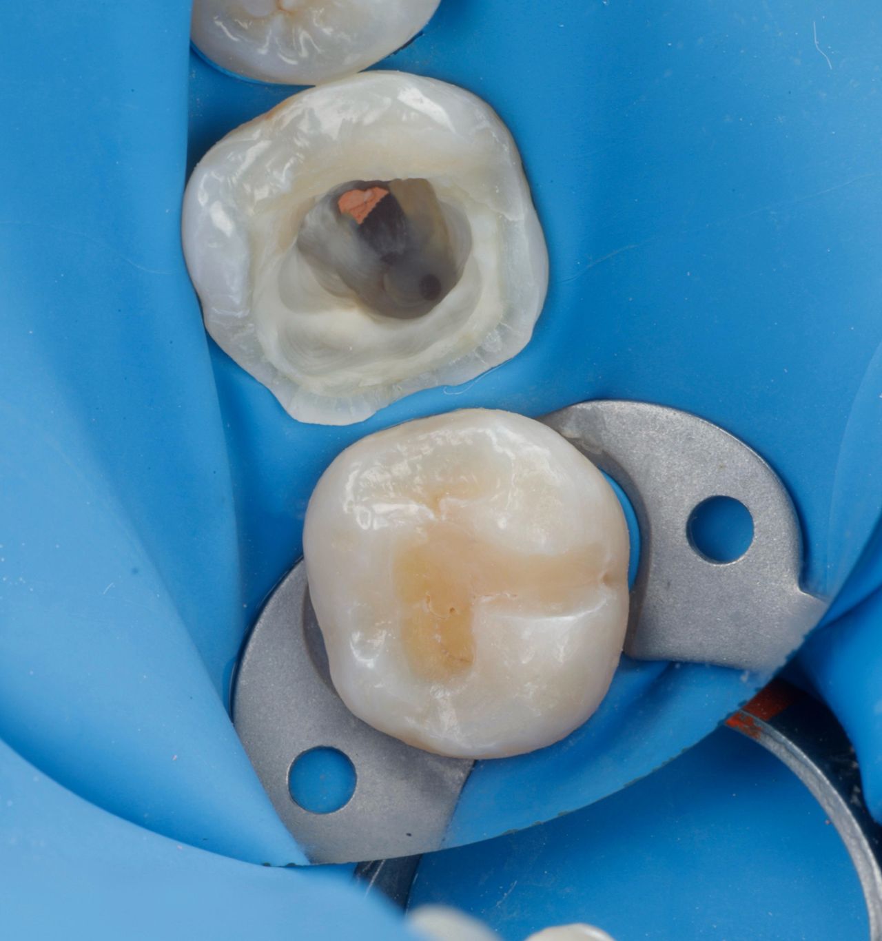 Fredy Alejandro Roblero Gónzalez-46