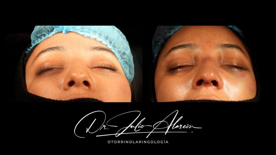 Julio César Alarcón Ortiz-5