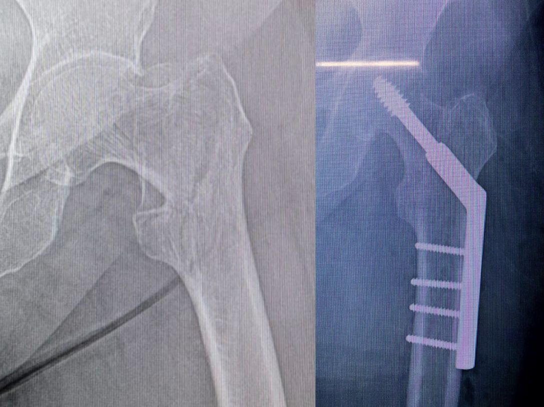 Diego Armando Contreras Rojas-6