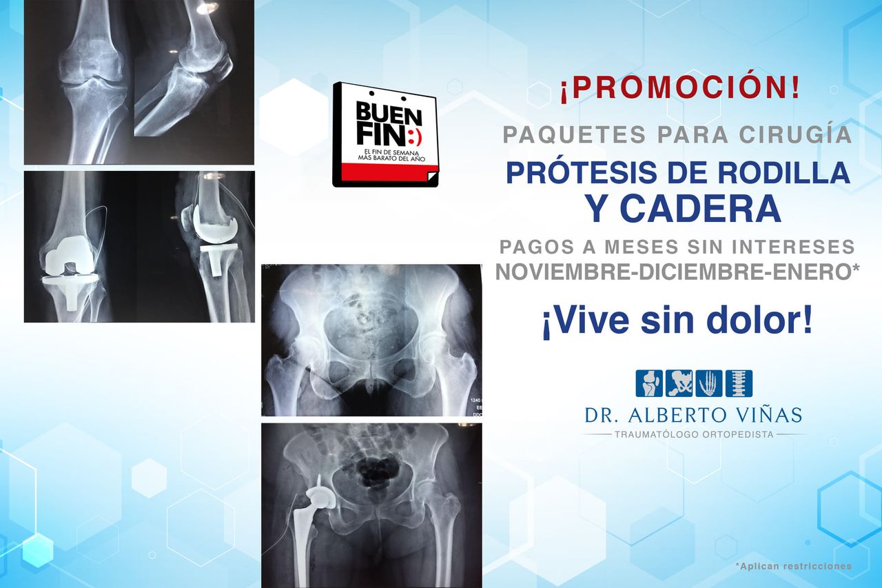 Alberto Viñas Silva-29