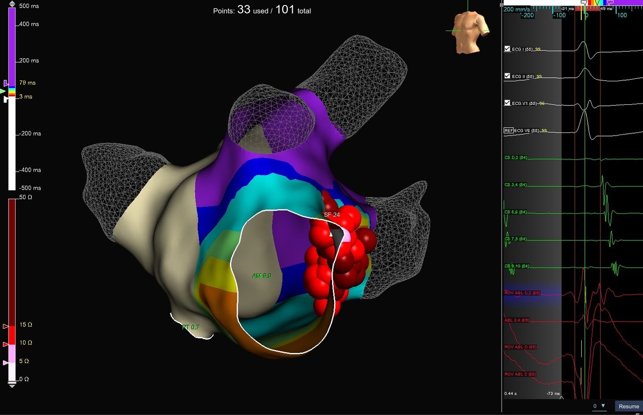 Elias Andrade Cuellar-2