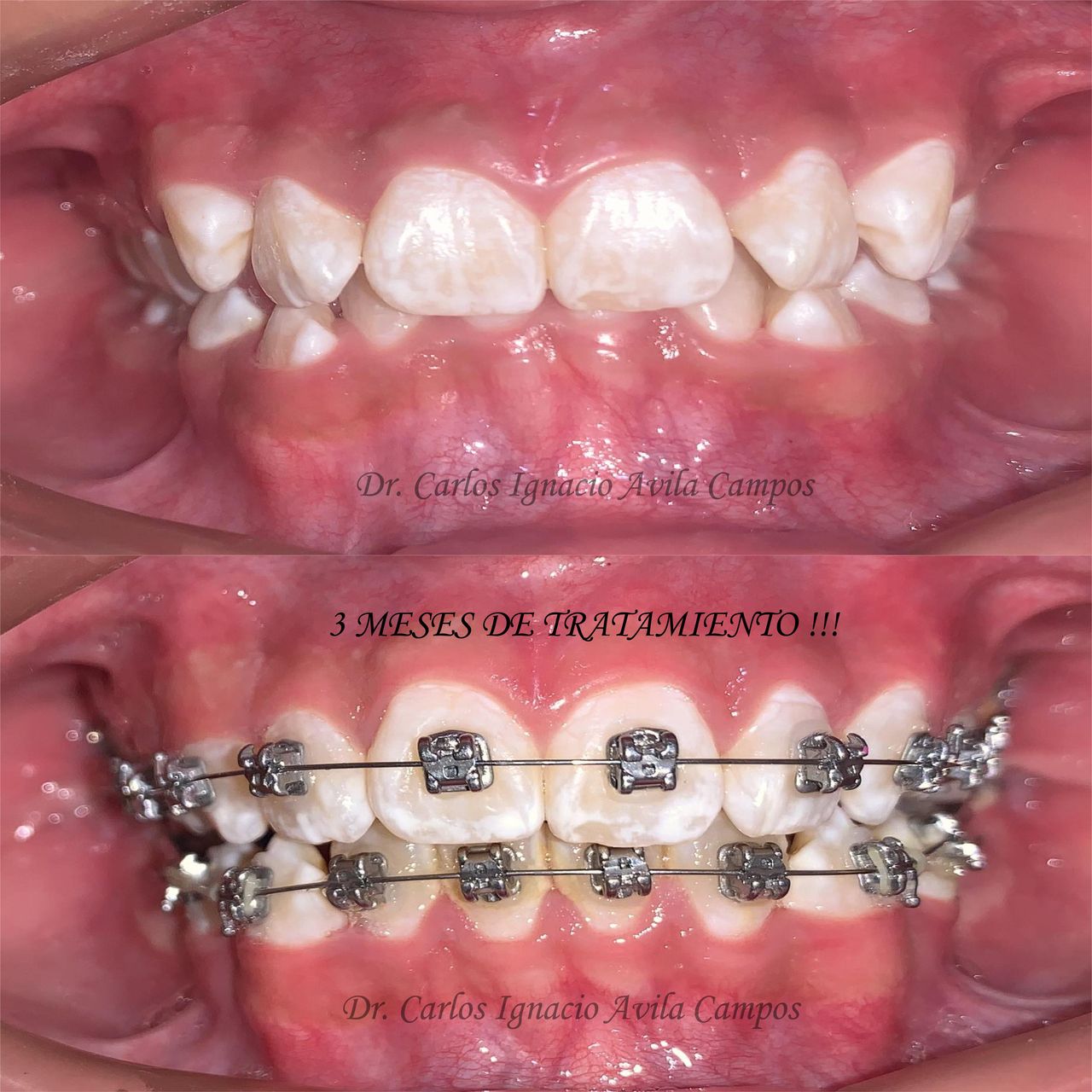 Carlos Ignacio Avila Campos-15