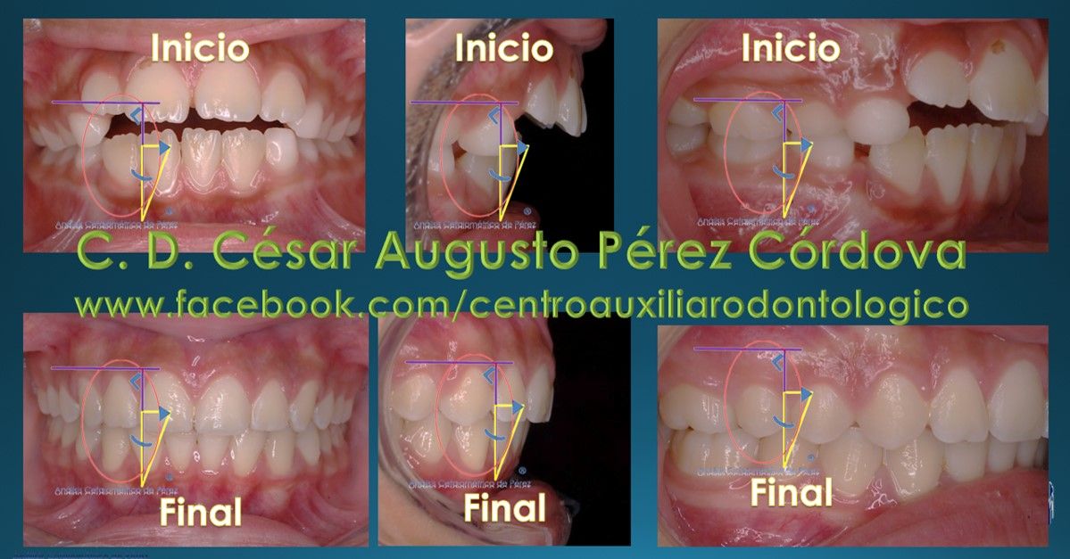 César Augusto Pérez Córdova-43