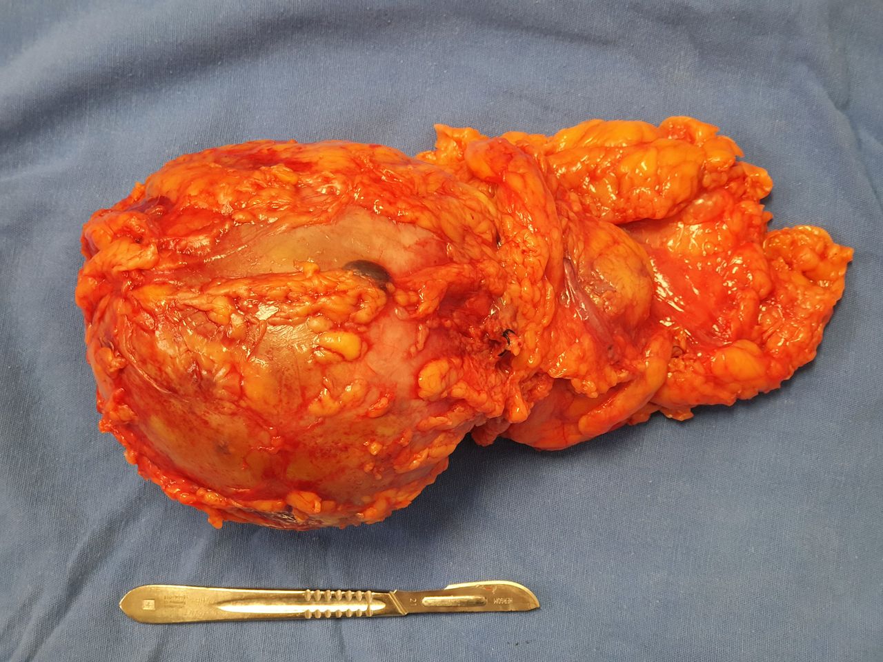 Víctor Hugo Tapia Romero-2