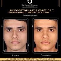 Enrique Serrano Cruz-10