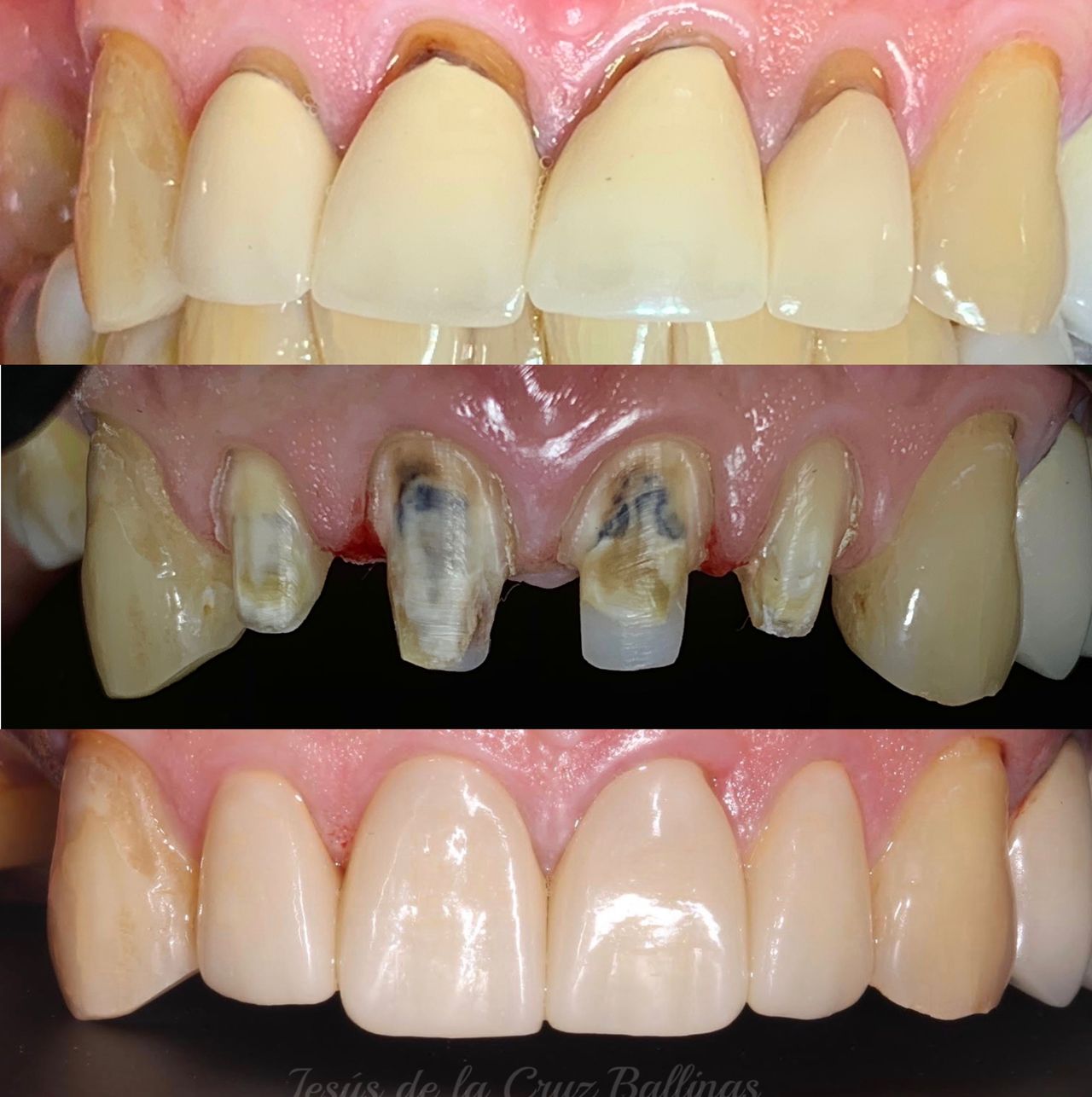 Jesus De La Cruz Ballinas-44