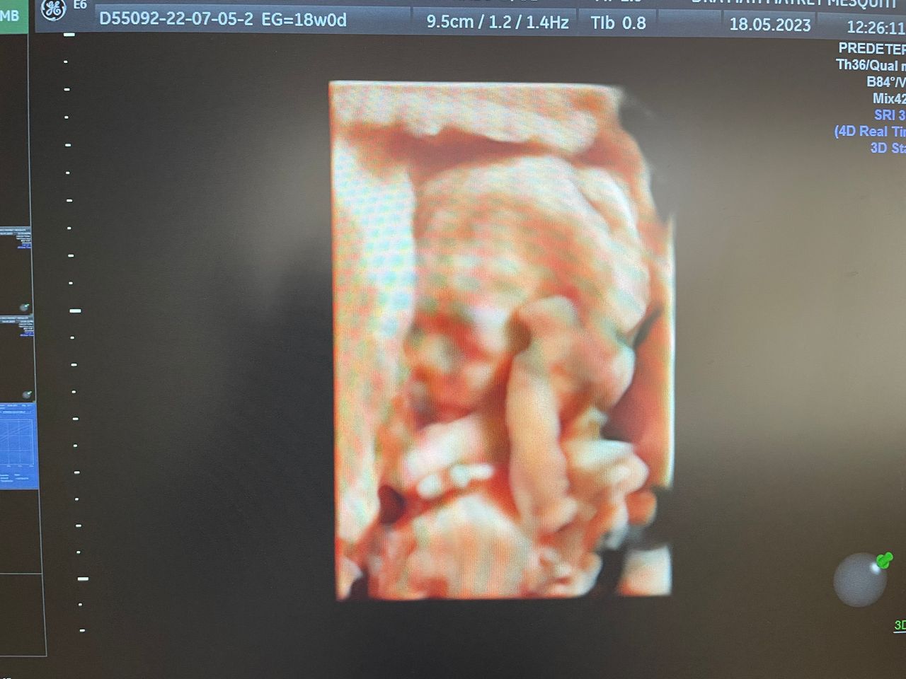 Mayi Mayret Mesquiti-0