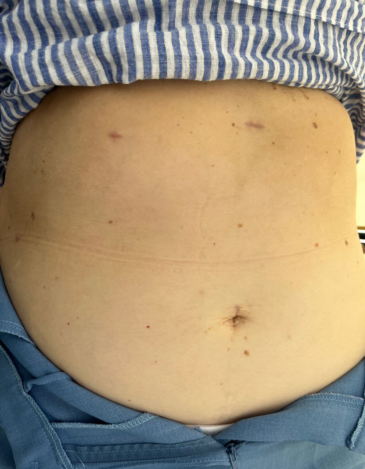 Bernardo Álvarez Hernández-3