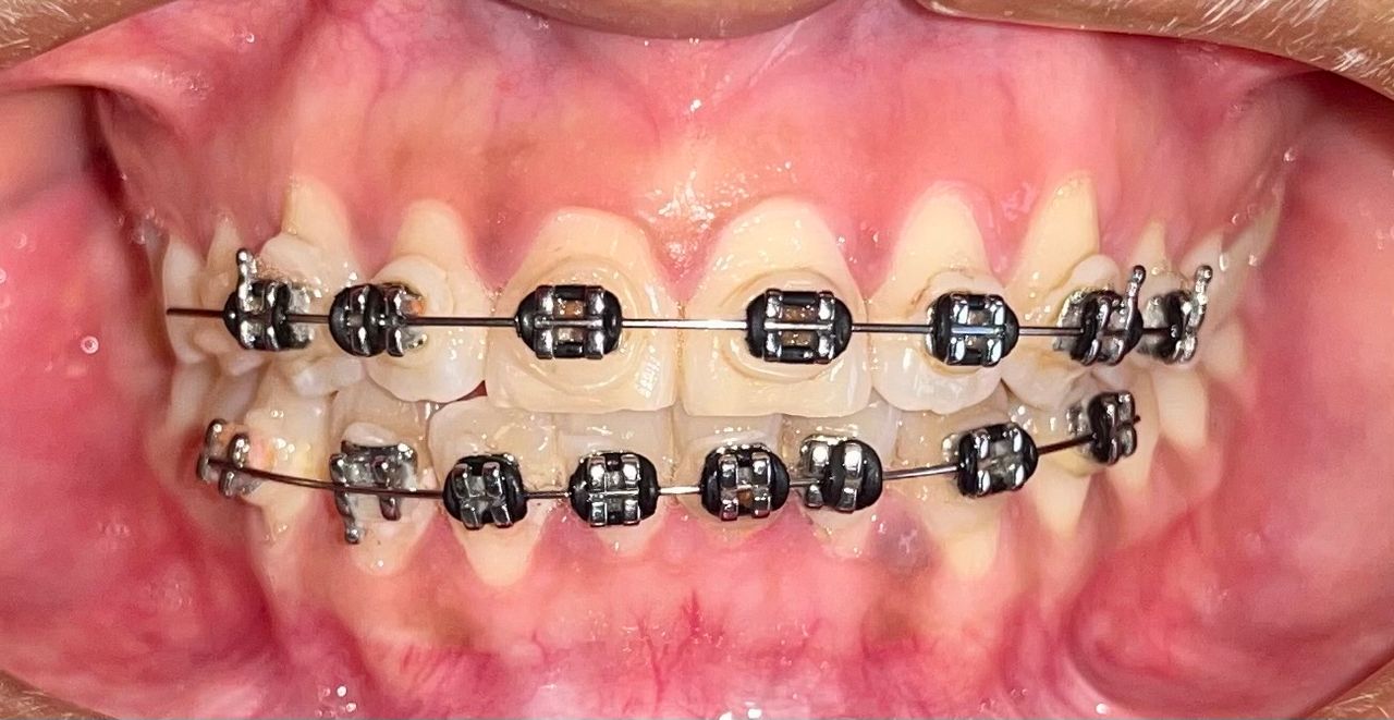 Zoe Guadalupe  Hernandez Aguilar-11