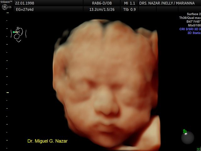 Miguel Angel González Nazar-18