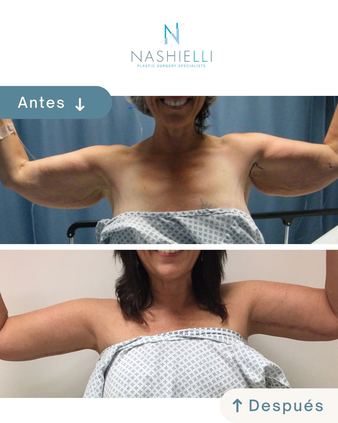 Nashielli Torres Espinosa Chiu-36