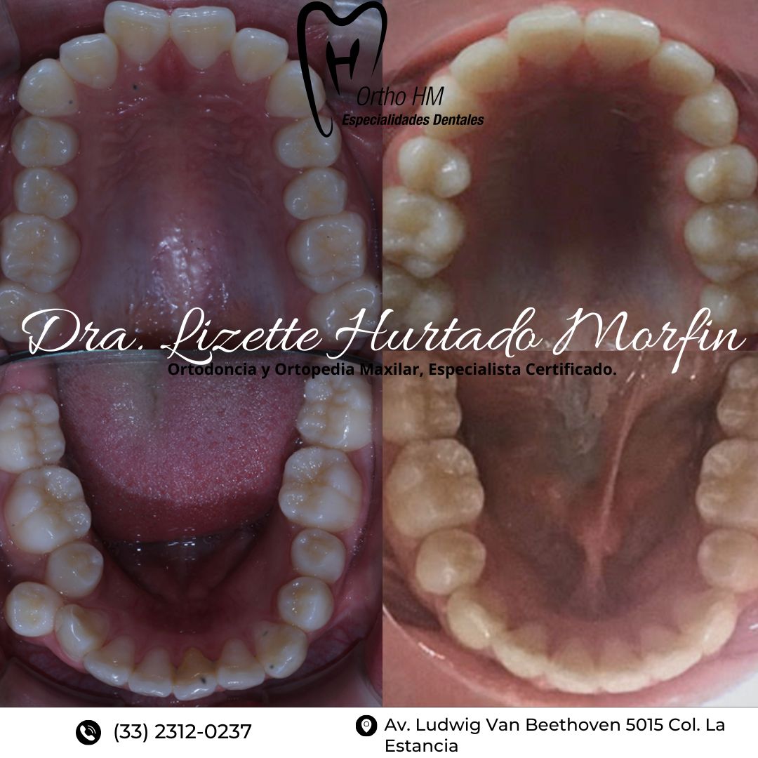 Lizette S. Hurtado Morfin-9