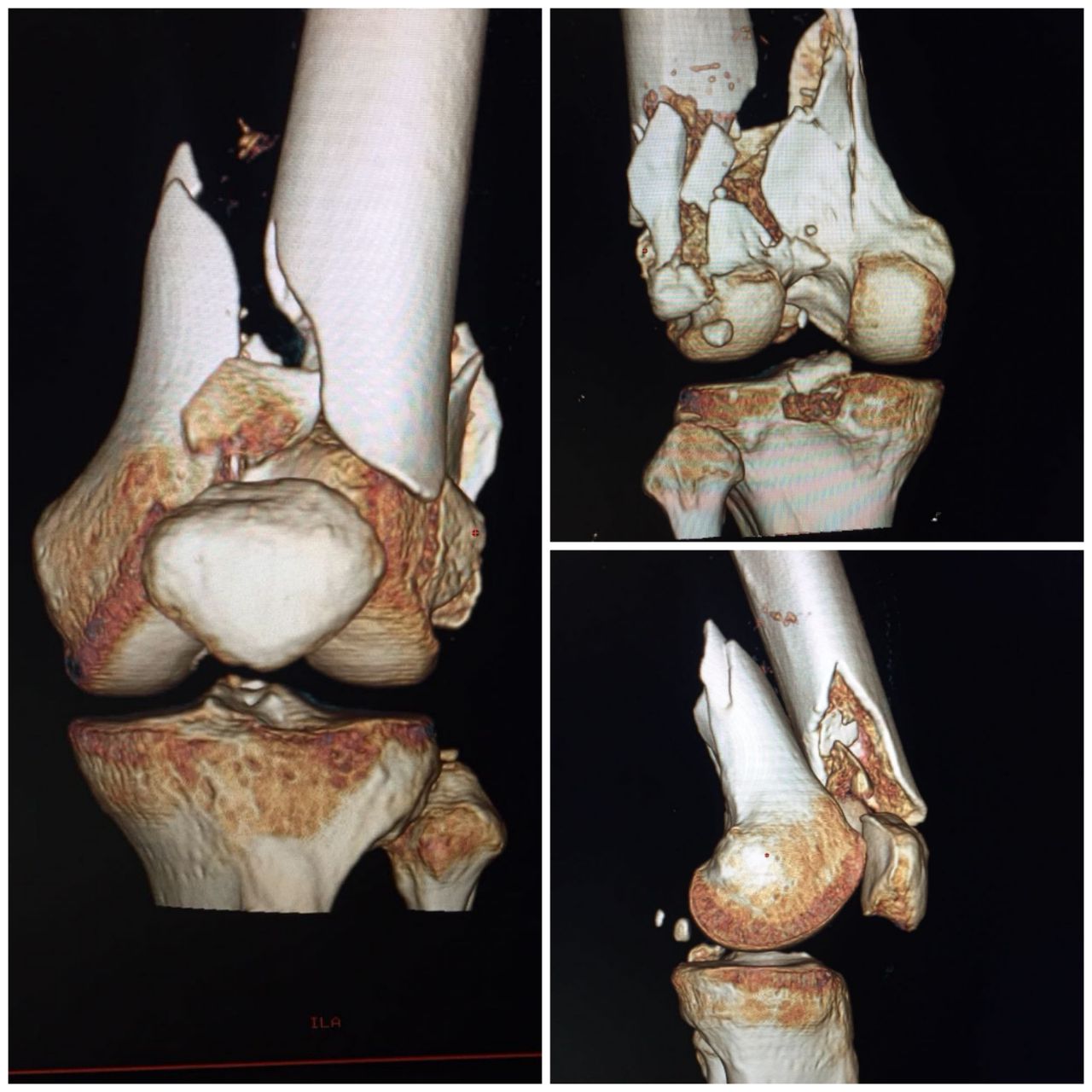 Gabriel De Leon Ochoa Lara-10