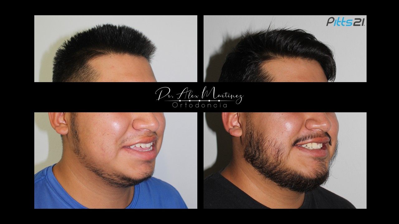 Alejandro Martínez Hernández-15