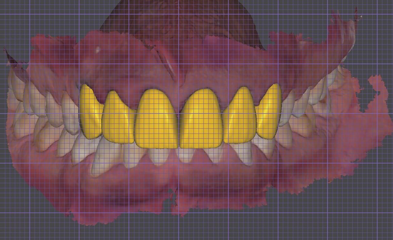 Aimee Valles Monárrez-51