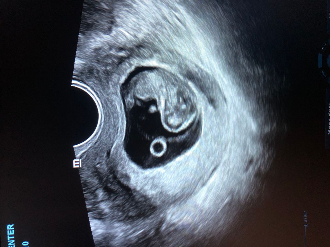 Ericka Gabriela Yac Longoria-0