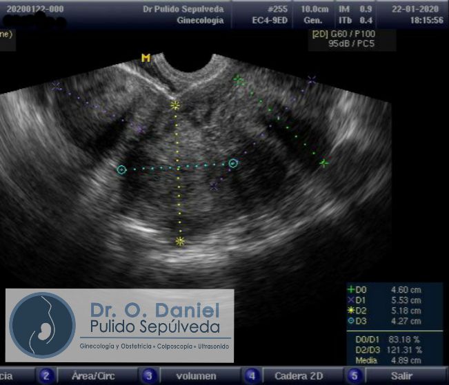 O. Daniel Pulido Sepúlveda-9