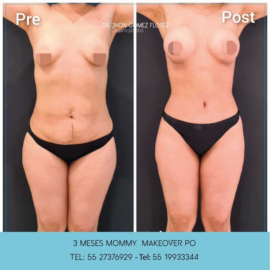 Jhon César Gómez Florez-5