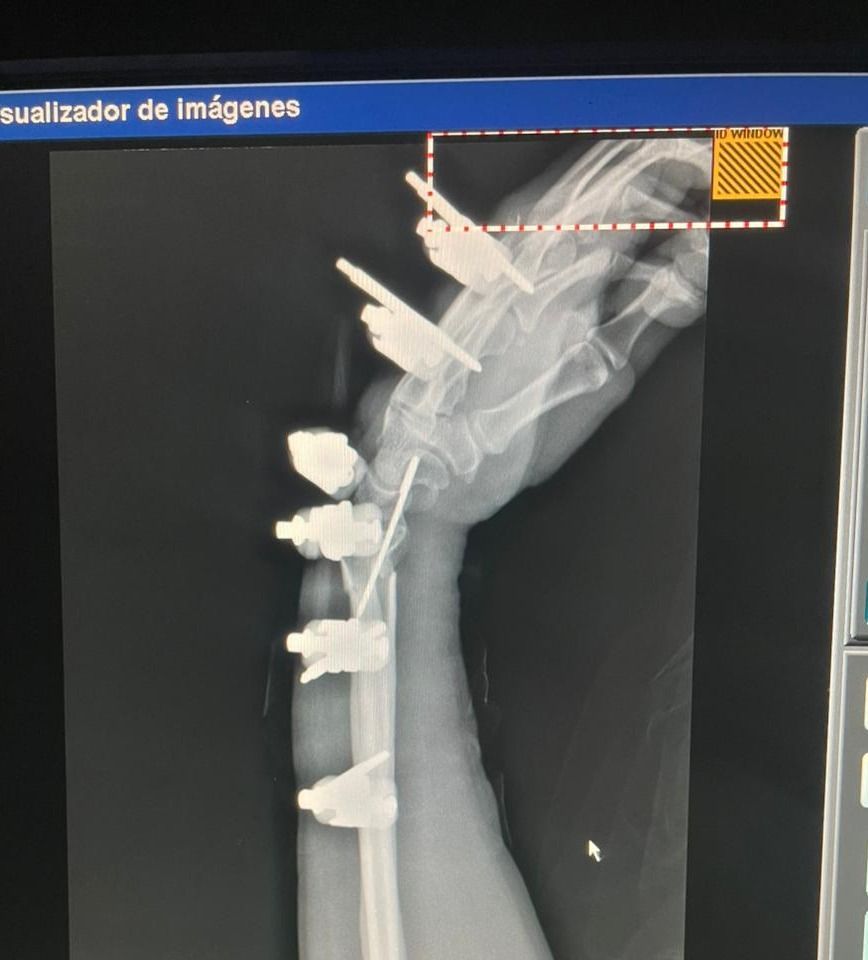 Max Georges Sainte Bernal-5