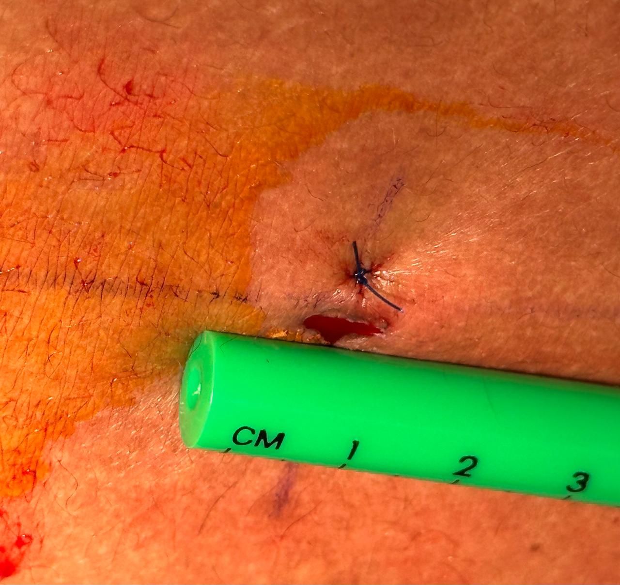 Valente Fragoza Padilla-20