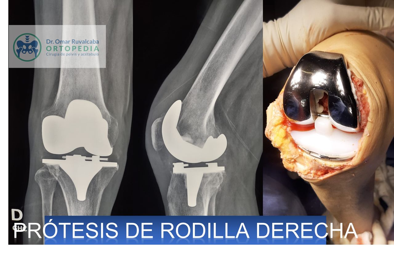 Omar Ruvalcaba Luna-17