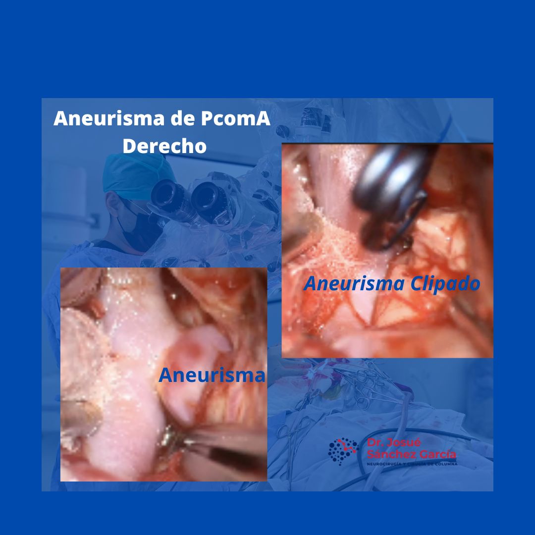 Josué Sánchez García-5