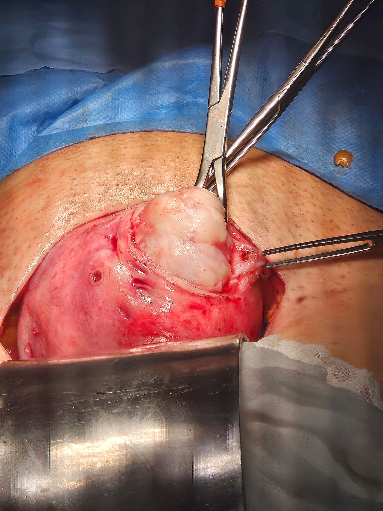 Jorge Alberto Rodriguez Pezino-57