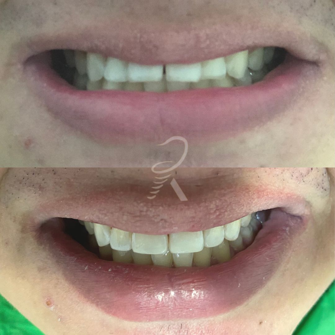 Andrea Rincón García-9