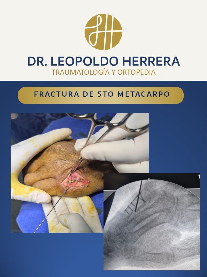Leopoldo José Herrera Camacho-14