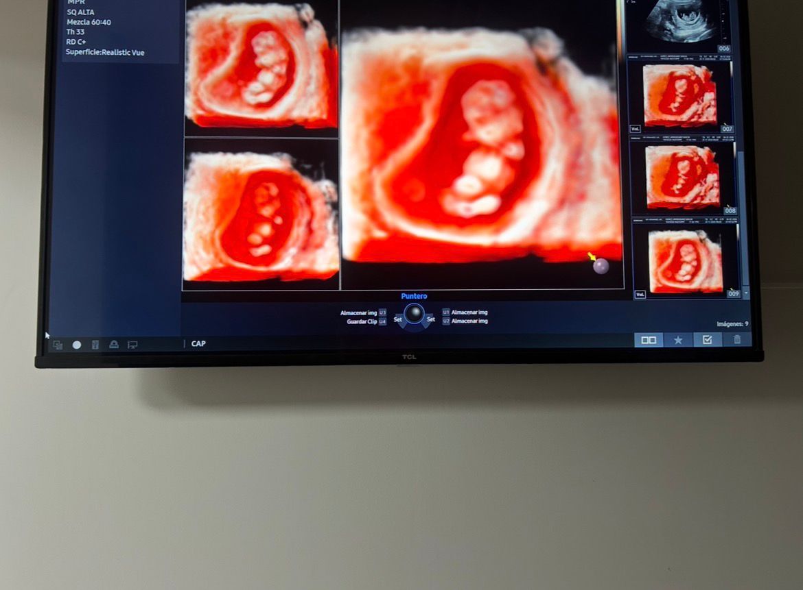 Javier Hernandez Montana-2