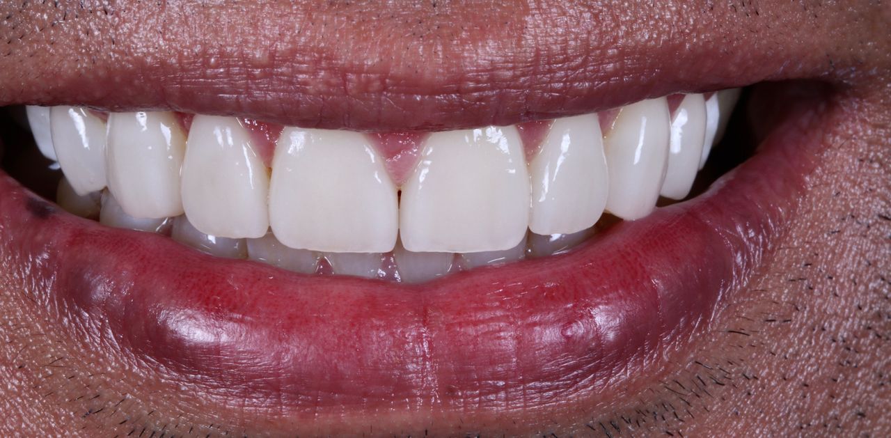 Ernesto Rojas Calderon-24