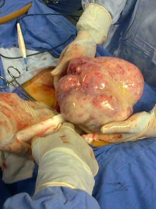 Alma Delia Arce Romero-15