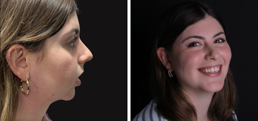 Federico Suastegui Carmona-7