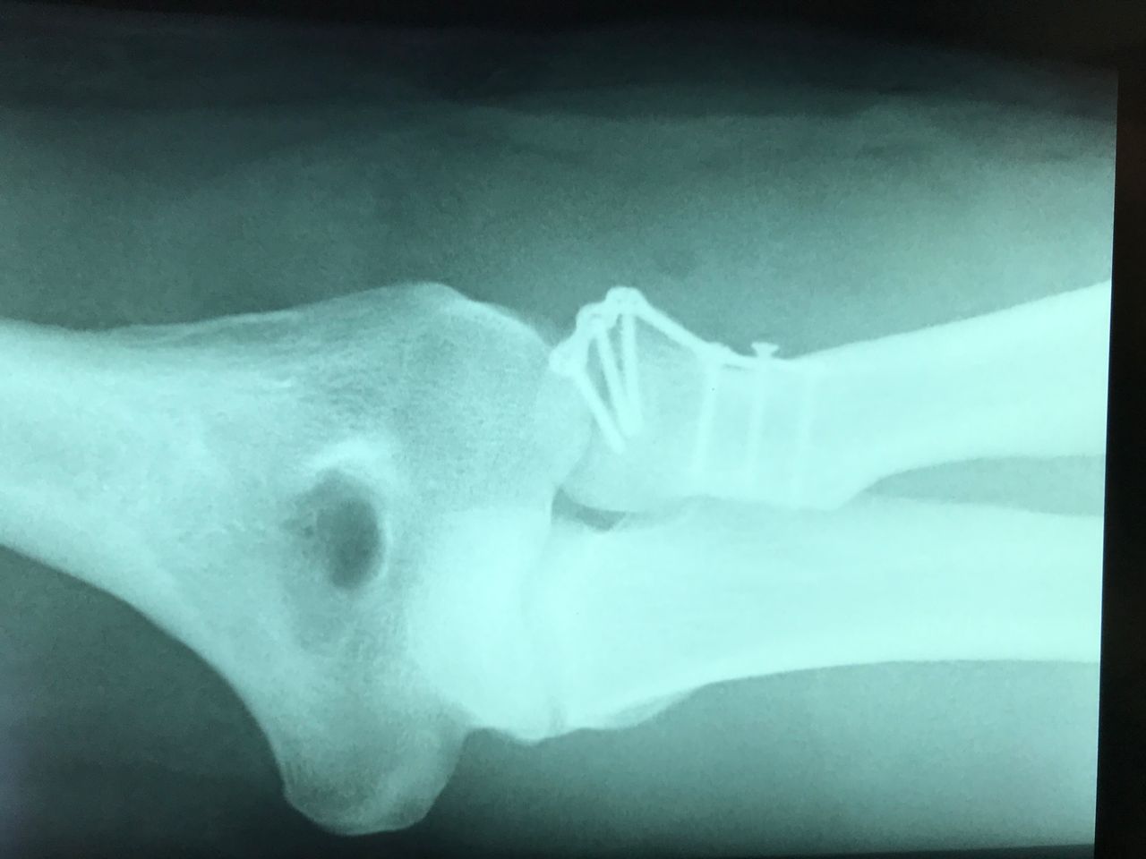 Eduardo Mondragón Marín-1