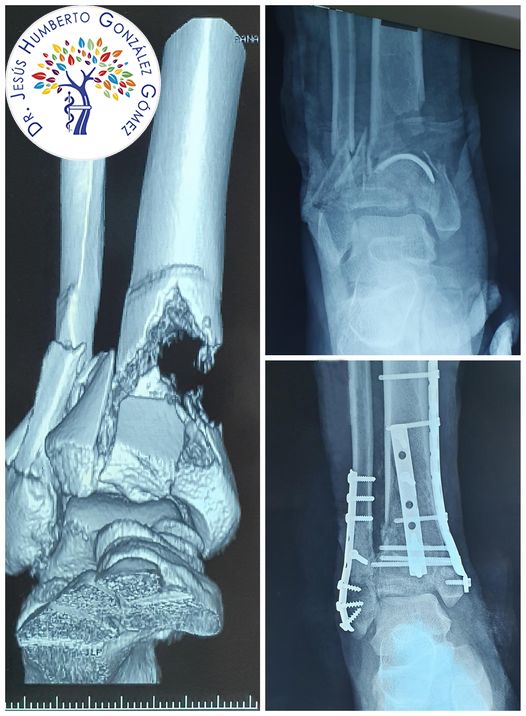 Jesús Humberto González Gómez-26