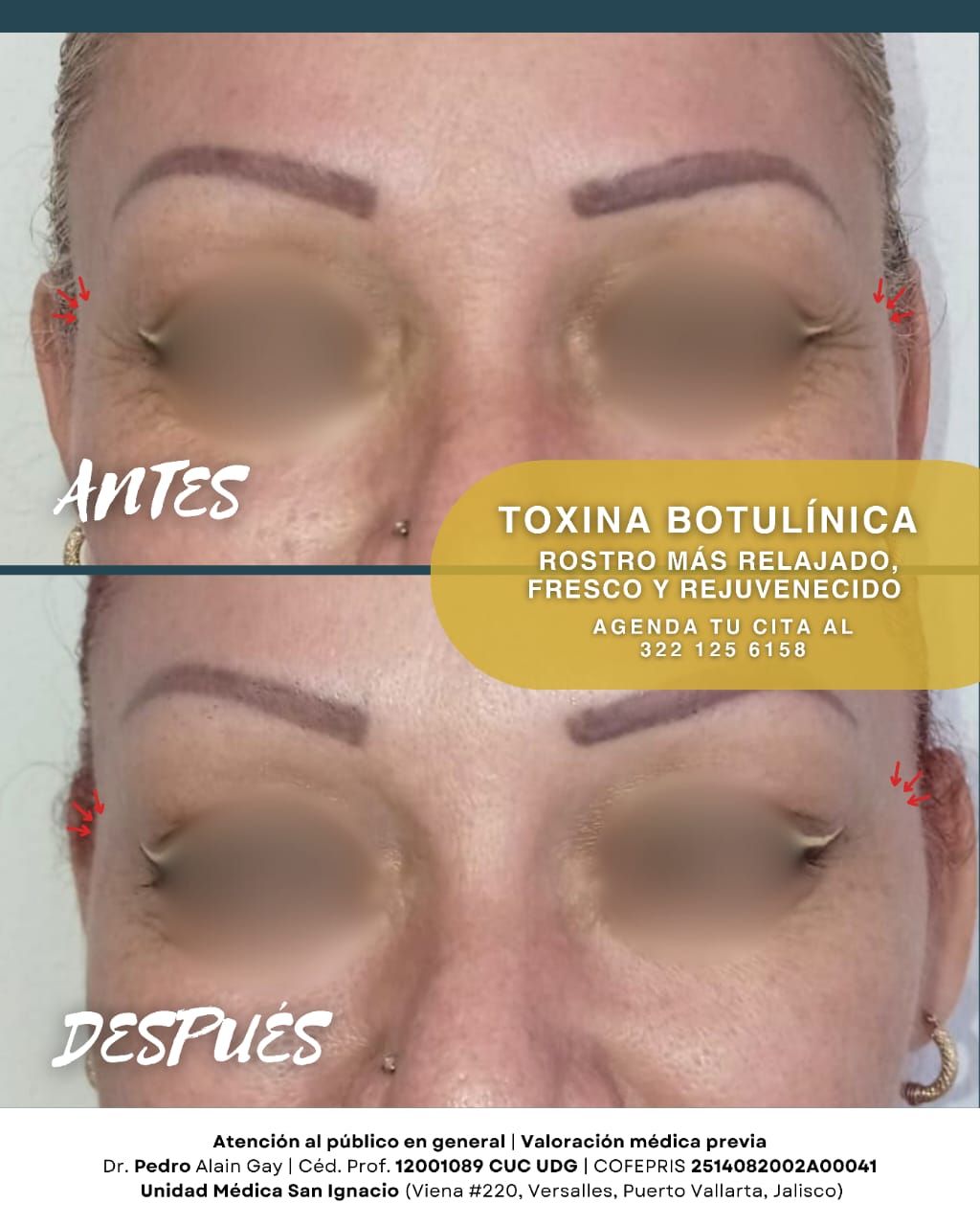 Pedro Alain  Gay Hernández -7