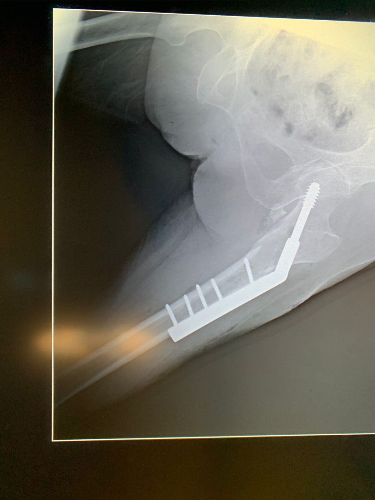 Christian G. García García-42