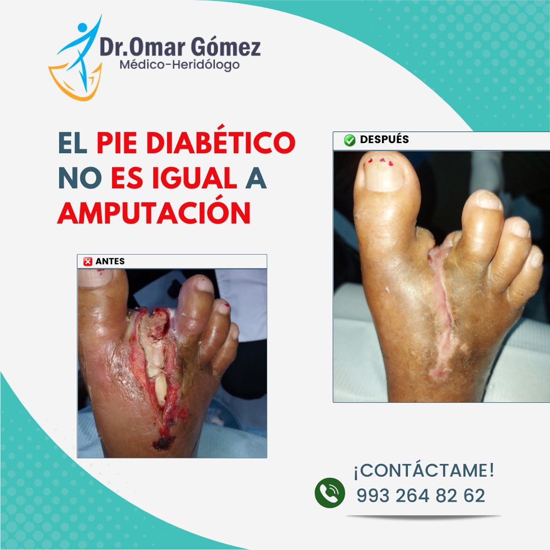 Omar Gómez López-5