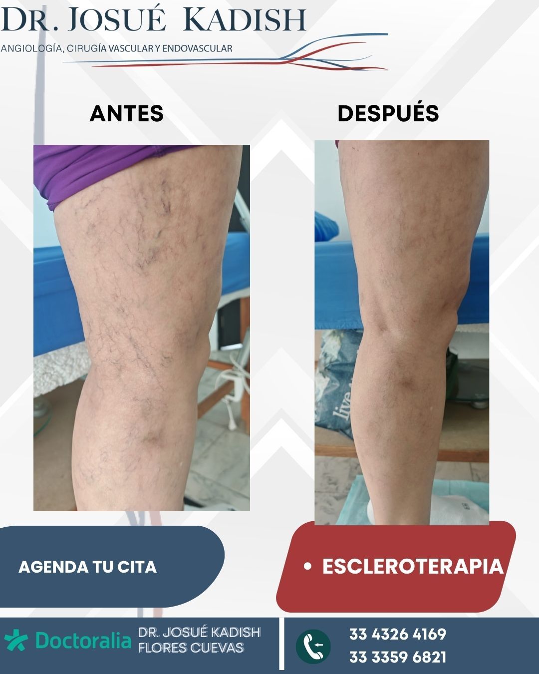 Josue Kadish Flores Cuevas-4