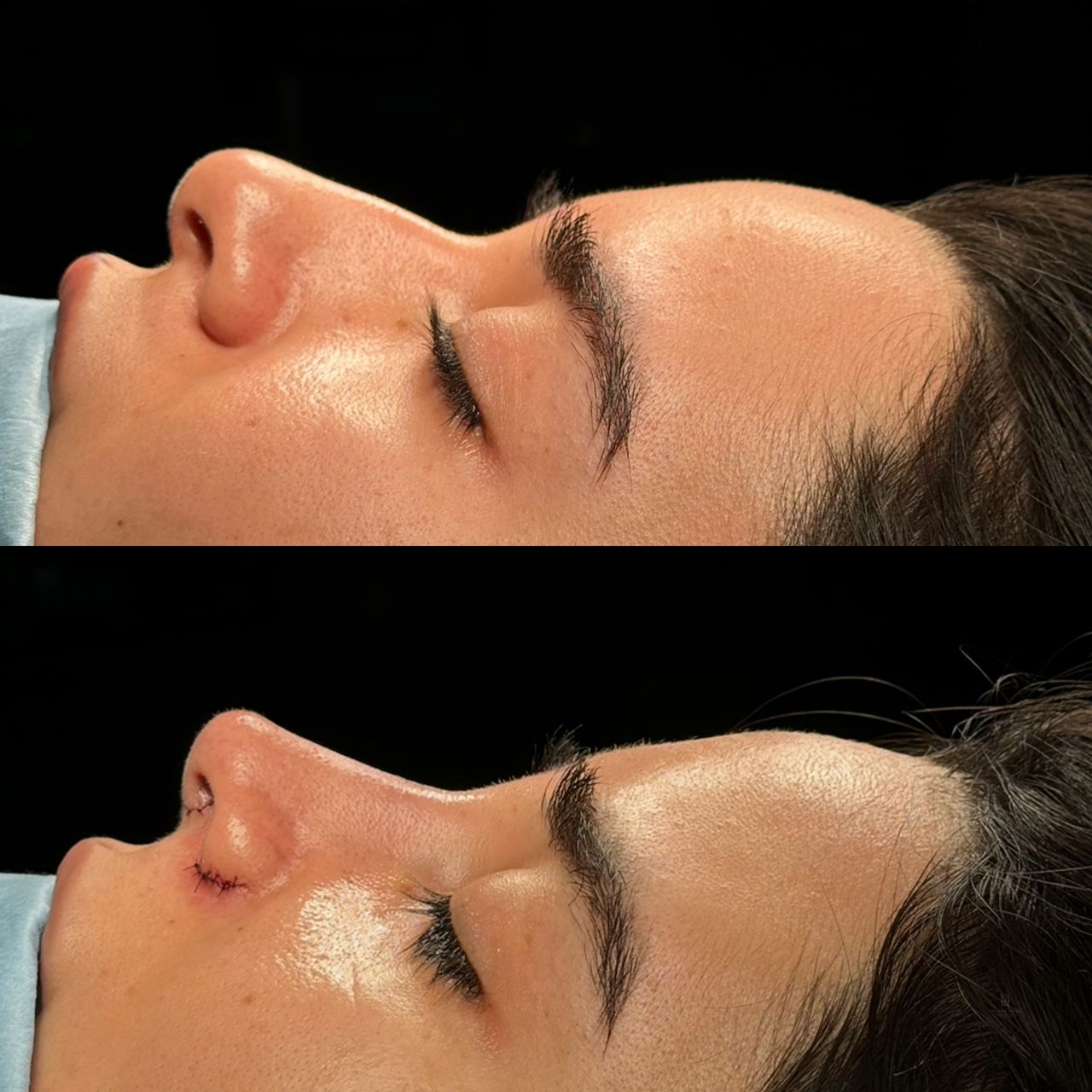 Angel Castro Urquizo-31