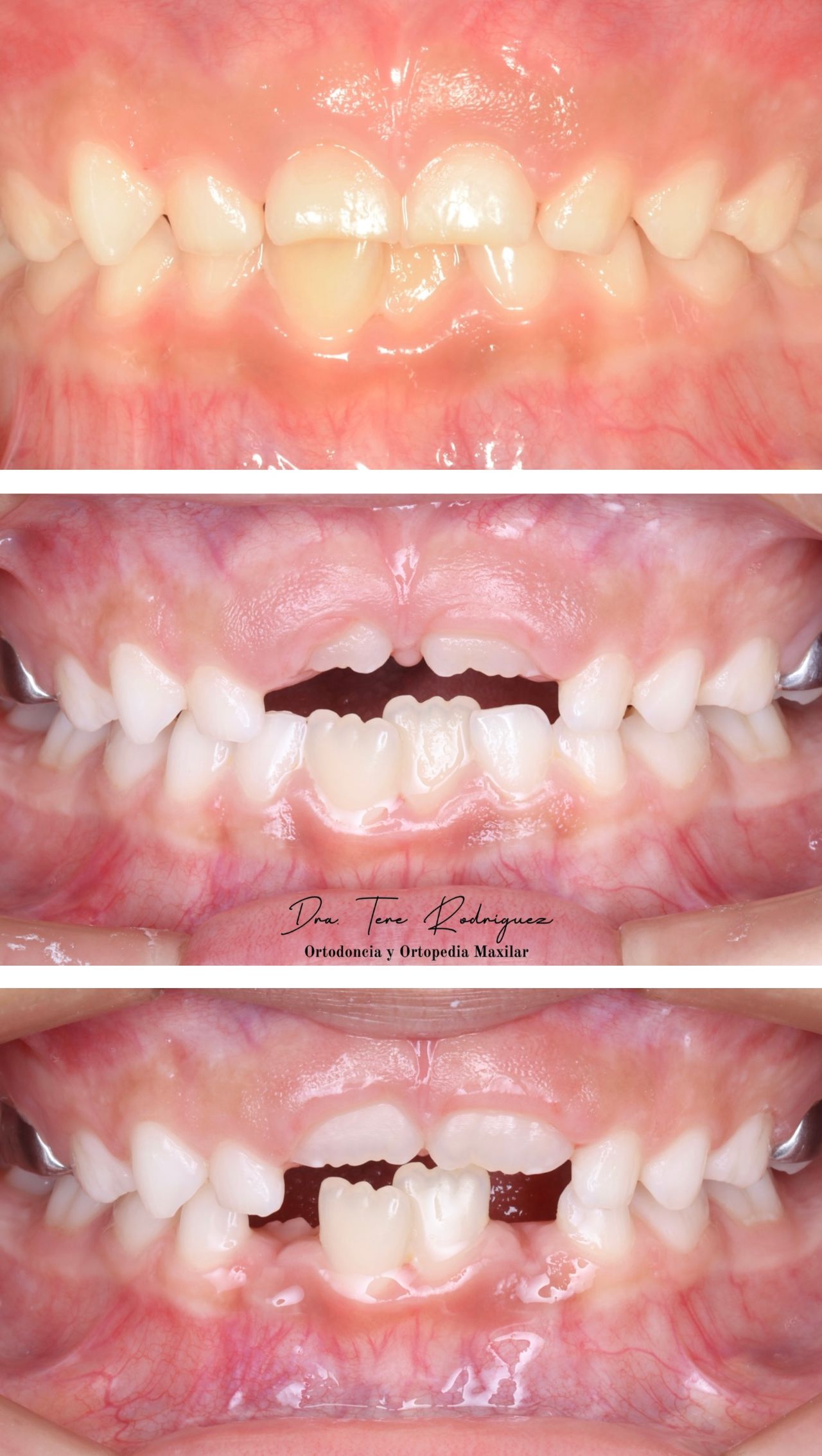 Teresa Rodriguez Candia-8