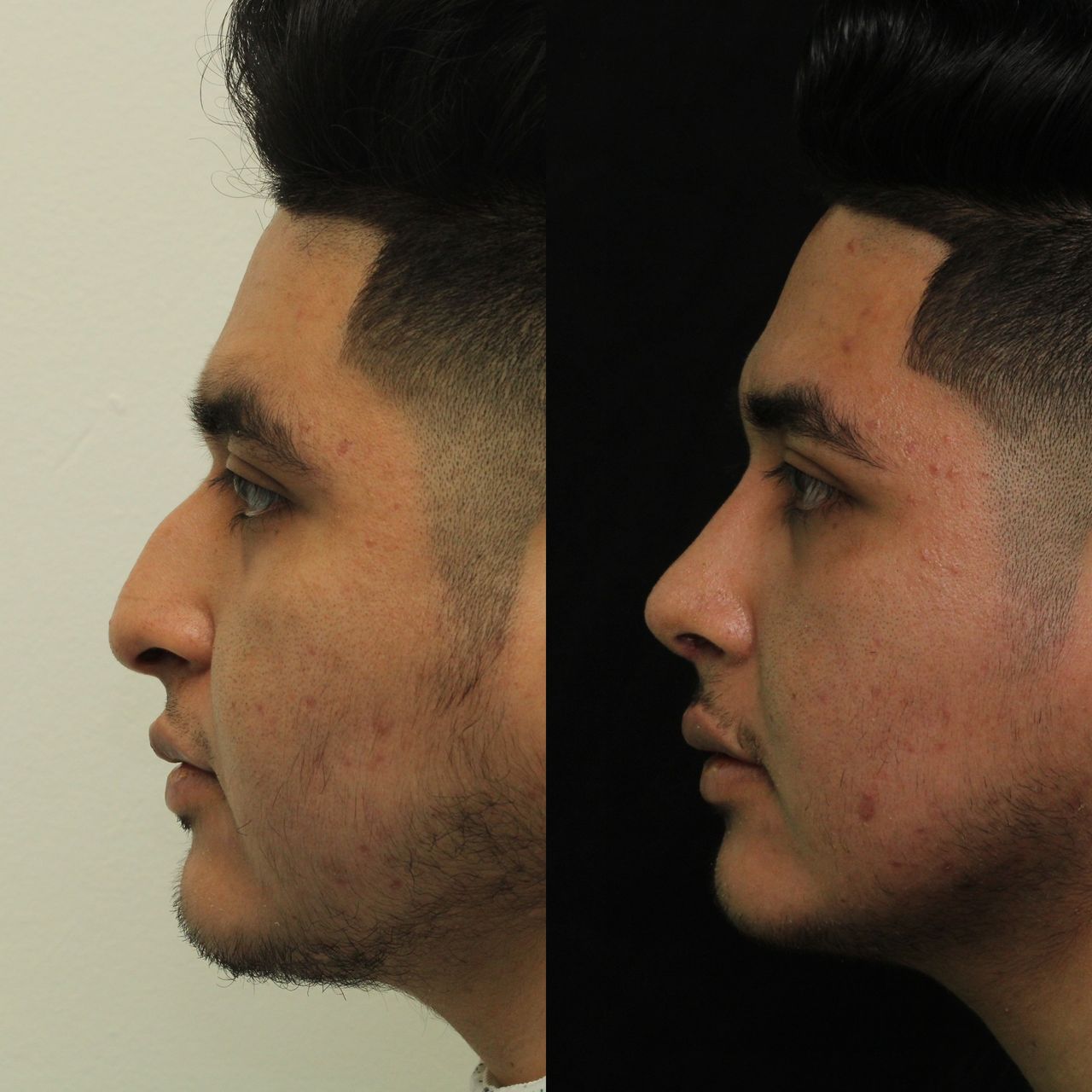 Angel Castro Urquizo-189