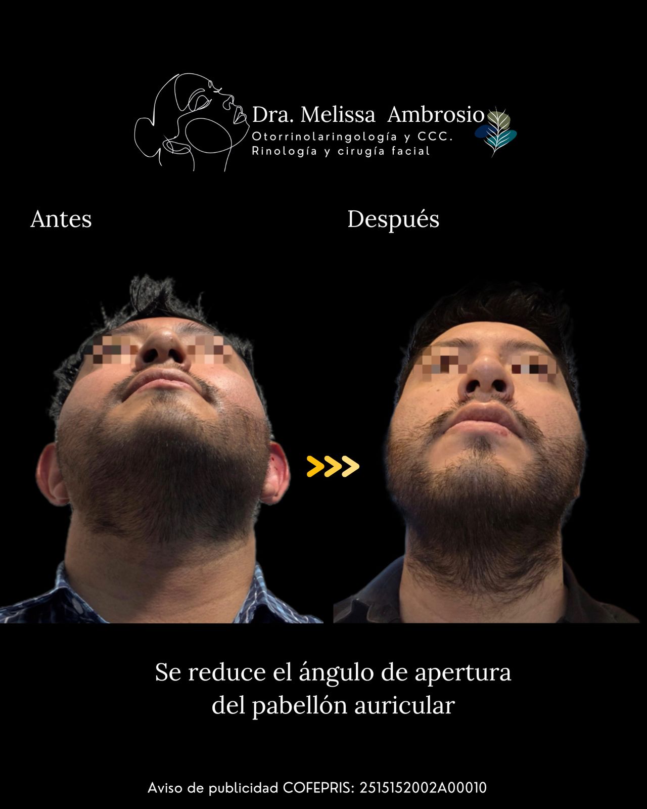 Melissa Guadalupe Ambrosio Mendoza-18