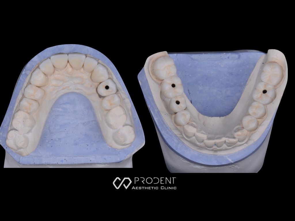 Ramiro Ivan Pérez Murillo-39